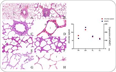 The Expression Regulatory Network in the Lung Tissue of Tibetan Pigs Provides Insight Into Hypoxia-Sensitive Pathways in High-Altitude Hypoxia